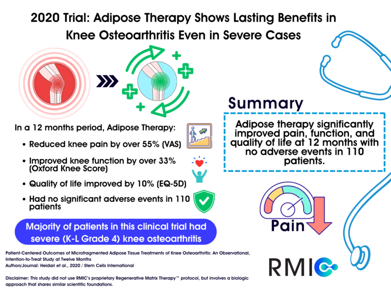 Infographic on Heidari 2020 clinical trial for severe knee osteoarthritis (OA)