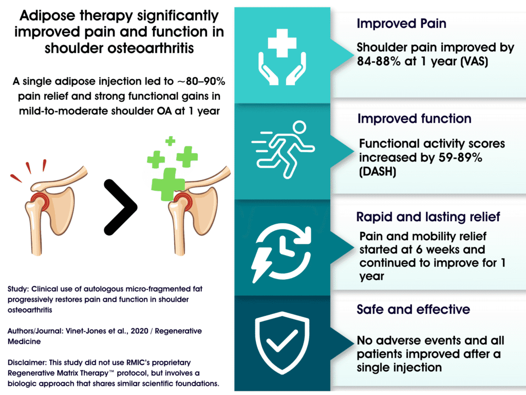 2020 Study: Adipose Injection Helped Mild-to-Moderate Shoulder OA