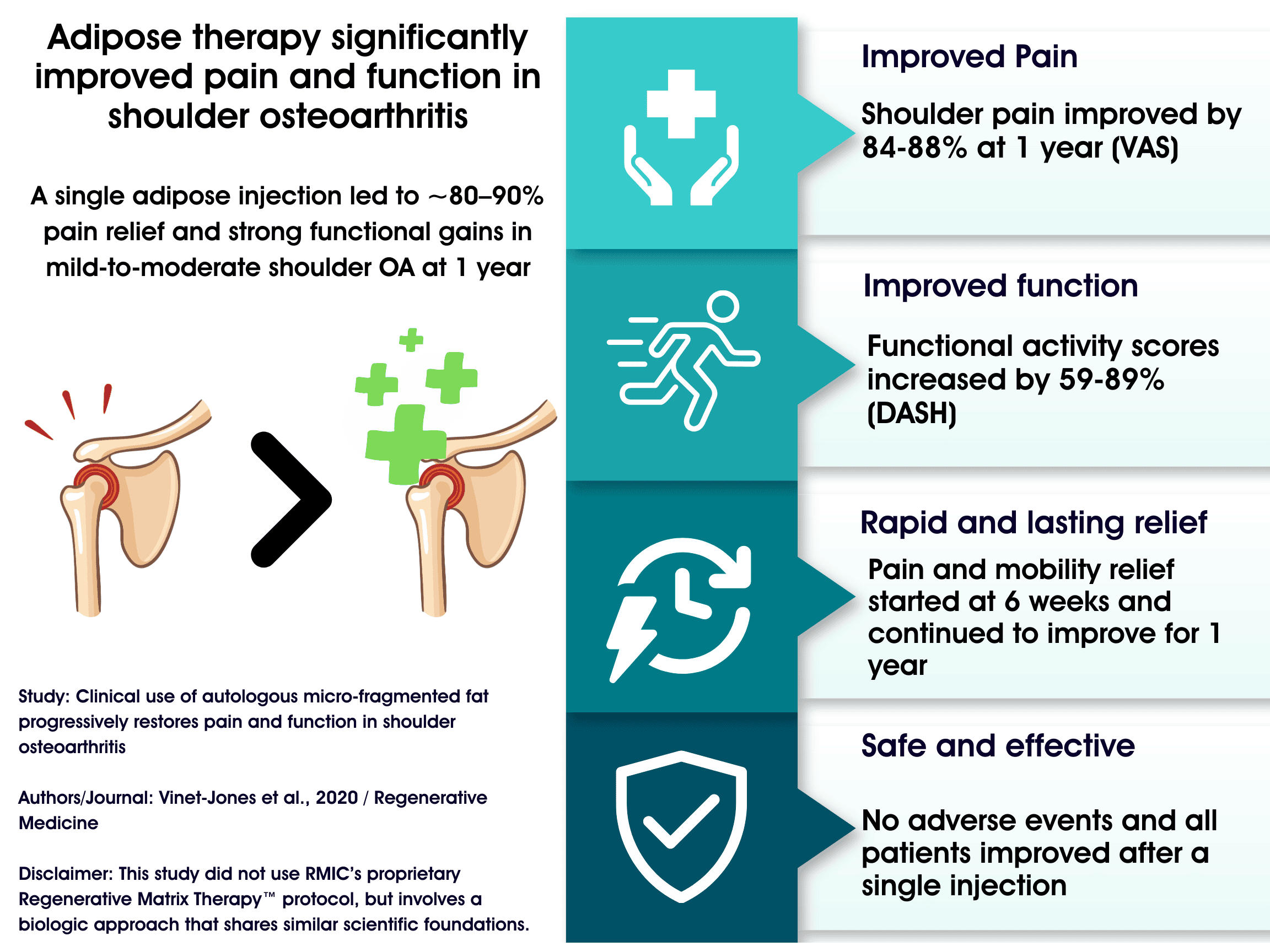 2020 Study: Adipose Injection Helped Mild-to-Moderate Shoulder OA