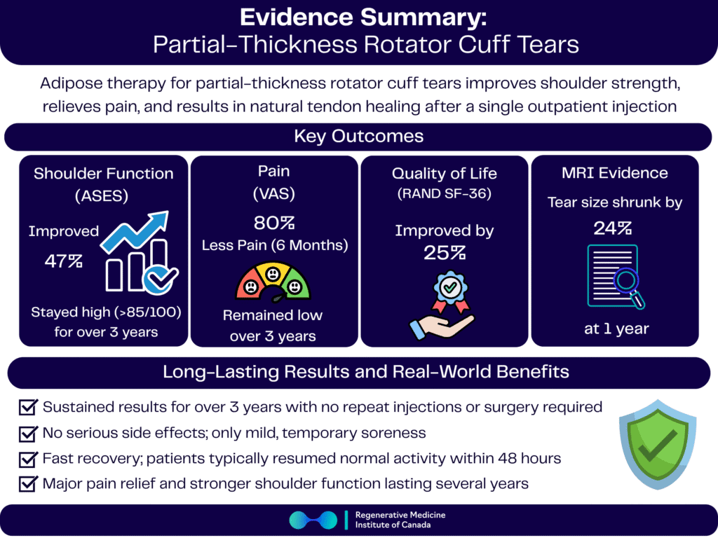 Evidence Summary: Adipose Therapy provides relief in partial thickness rotator cuff tears