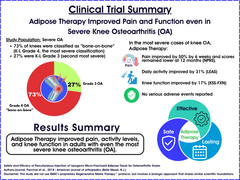 2018 Study: a single adipose injection for severe “bone-on-bone” knee OA reduced pain and boosted function at 12 months, with no serious adverse events.