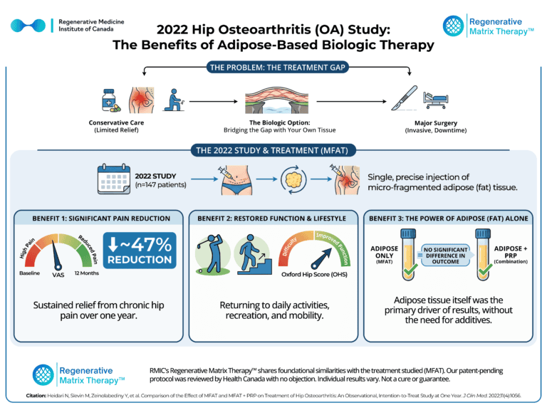 An illustration of adipose tissue therapy for hip osteoarthritis, highlighting the treatment process and benefits for pain relief, function, and adipose tissue's role.