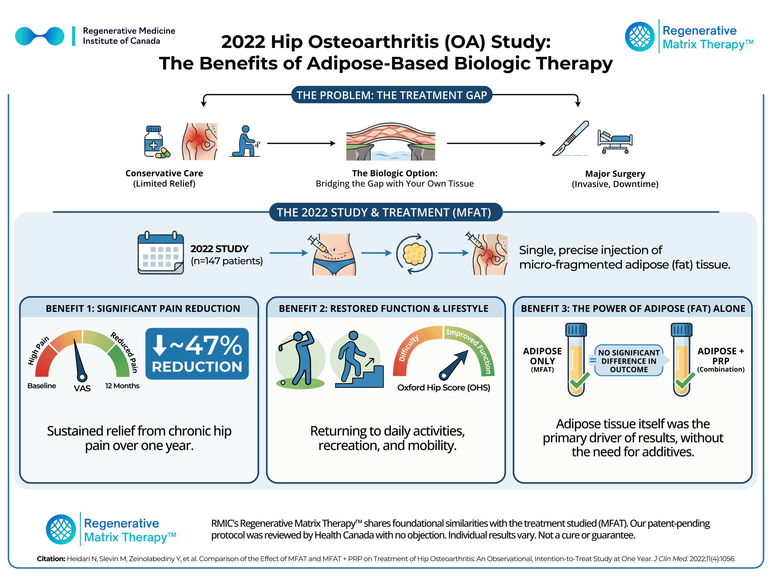 An illustration of adipose tissue therapy for hip osteoarthritis, highlighting the treatment process and benefits for pain relief, function, and adipose tissue's role.